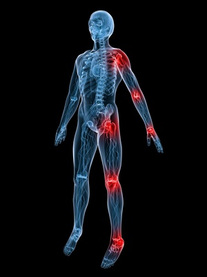 Alleviate the Pain of Arthritis using Handy Cure